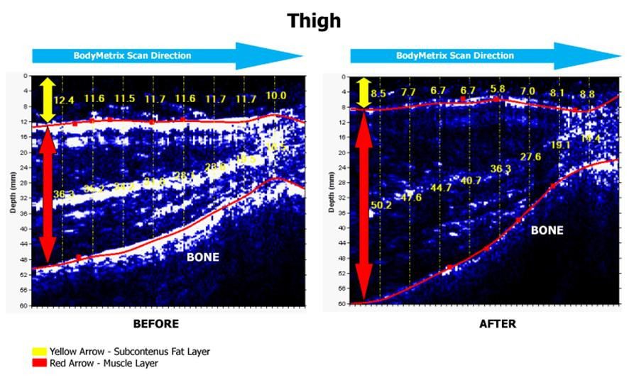 equipamentos não convencionais na avaliação física: antes e depois da avaliação